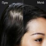 Toppik Ίνες Κάλυψης Αραίωσης Μαλλιών 12gr Toppik Ίνες Κάλυψης Αραίωσης Μαλλιών 12gr